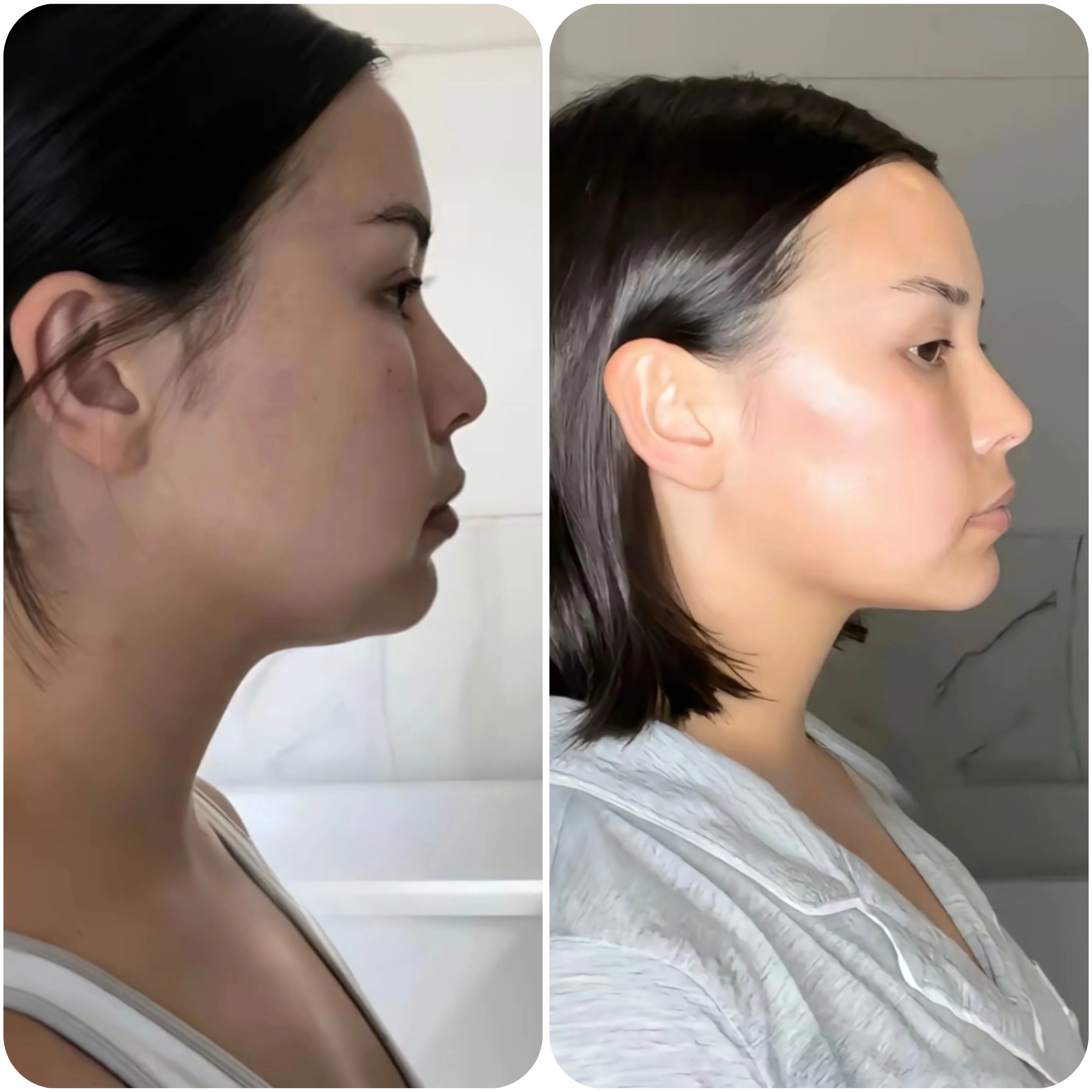 Masque Liftant pour le Visage en V et Bande Amincissante pour le Menton/les Joues